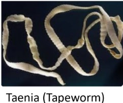 Parasites of medieval Leith